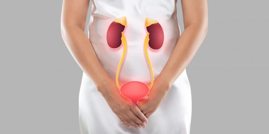 Female cystitis is an inflammation that occurs in the bladder tissue